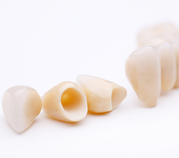 Plano Dental Crowns and Dental Bridges